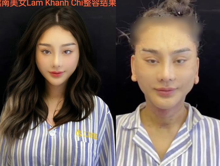 Lâm Khánh Chi 'photoshop' ảnh đi phẫu thuật: Nhan sắc thật khác xa trên mạng Ảnh 4