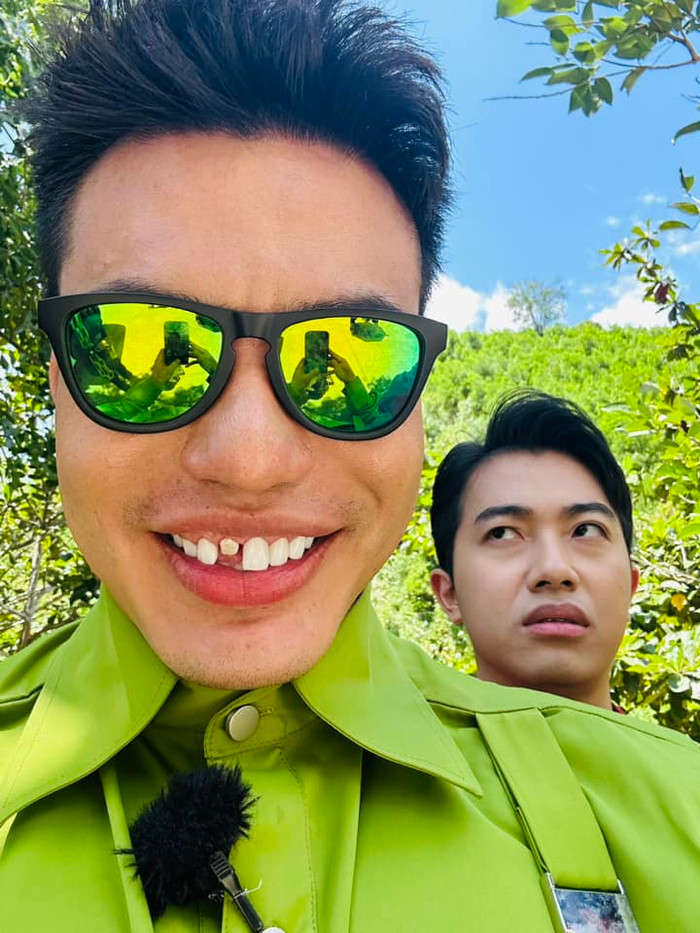 Cận cảnh chiếc răng bị rớt của anh chàng.