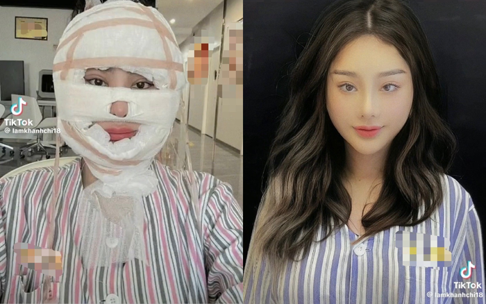 Hình ảnh Lâm Khánh Chi sang Trung Quốc phẫu thuật thẩm mỹ khiến dân tình xôn xao.