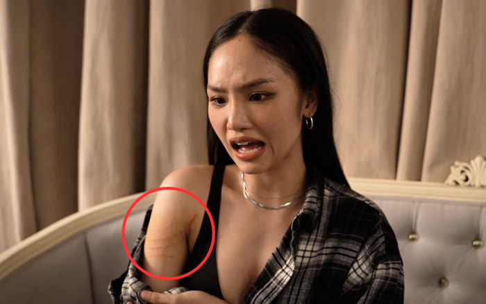 Miu Lê bị thương khi đóng phim khiến khán giả xót xa Ảnh 2