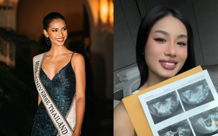 Thảo Nhi Lê trữ trứng, mỹ nhân Thái bận thi MU cũng 'hóng chuyện', bình luận 1 câu thân thiết Ảnh 2