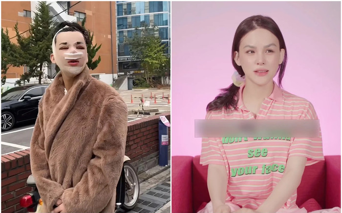 Diện mạo mới của Trần Đức Bo ra sao sau thời gian 'trùng tu' mà dân tình phải ngạc nhiên? Ảnh 2