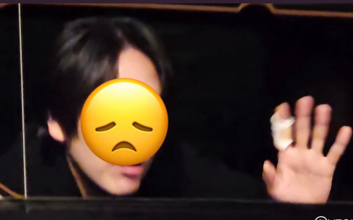 Nam diễn viên chấn thương do bị một người phụ nữ tấn công trong phòng thay đồ Ảnh 2