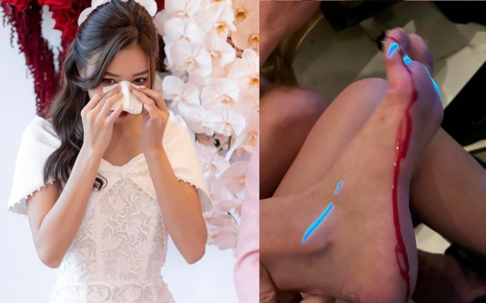 Một nữ diễn viên gặp sự cố đổ máu trong đám cưới Puka - Gin Tuấn Kiệt Ảnh 2