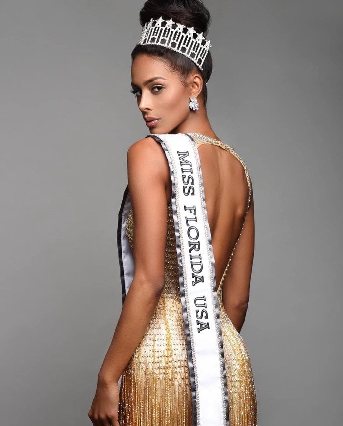 Á hậu 1 Hoa hậu Liên lục địa tìm kiếm tấm vé đến Miss Universe 2024, quá khứ ra sao mà dân tình quan ngại? Ảnh 2