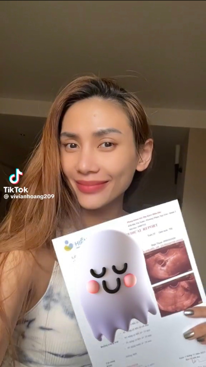 Võ Hoàng Yến hào hứng khoe phiếu khám sau một thời gian tiêm thuốc