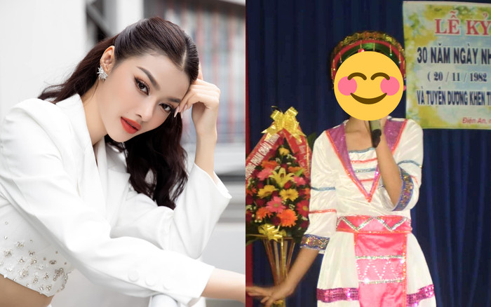 Một Á hậu 'lên hương' visual nhờ phẫu thuật thẩm mỹ, không ngại công khai ảnh hồi còn đen nhẻm Ảnh 2