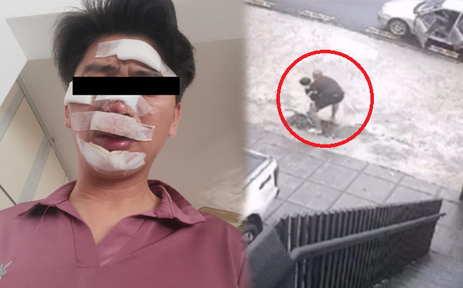 Người cha kể lại phút liều mạng đuổi theo lũ bắt cóc con trai và cái kết bất ngờ phía sau Ảnh 2