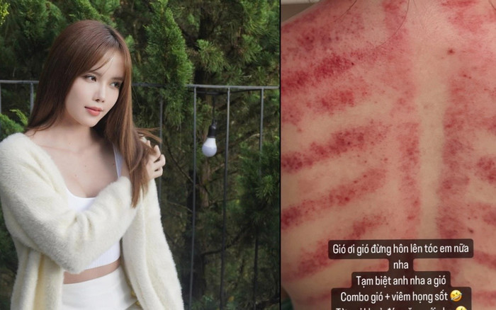 Thiều Bảo Trâm gặp vấn đề sức khỏe, tình hình hiện tại ra sao? Ảnh 2