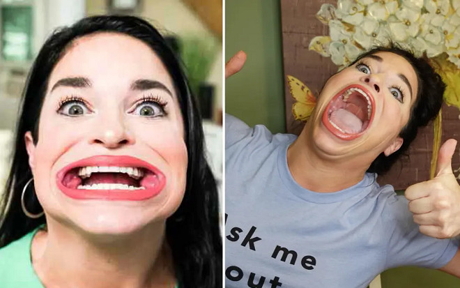 Người phụ nữ với chiếc miệng rộng nhất thế giới kiếm bộn tiền từ những lời chê bai 'mồm ếch' Ảnh 2