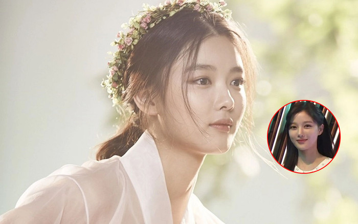 Kim Yoo Jung mất điểm vì làm mũi: Nhan sắc nữ thần khi yêu Park Bo Gum nay còn đâu Ảnh 2