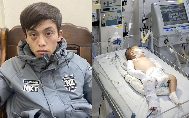 Bắt khẩn cấp gã người tình của mẹ, hành hạ bé 3 tháng tuổi đến gãy xương Ảnh 2