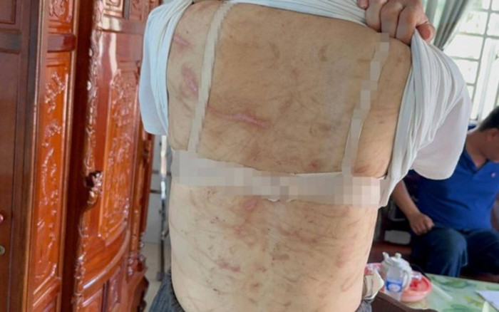 Vụ vợ mang thai 7 tháng bị chồng bạo hành như thời trung cổ: Bất ngờ trước lời khai của người chồng Ảnh 2