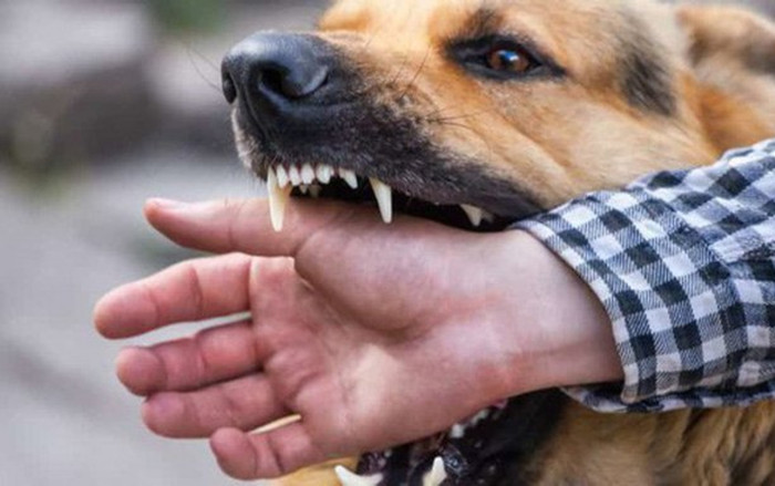 Sau 3 tháng bị chó nhà cắn, người phụ nữ nhận cái kết không thể cứu vãn Ảnh 2