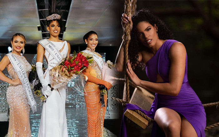 Hoa hậu Hoàn vũ Curacao 2023 lộ diện: Chiều cao 'đụng trần nhà', nhan sắc gây tranh cãi vì kém nữ tính Ảnh 2