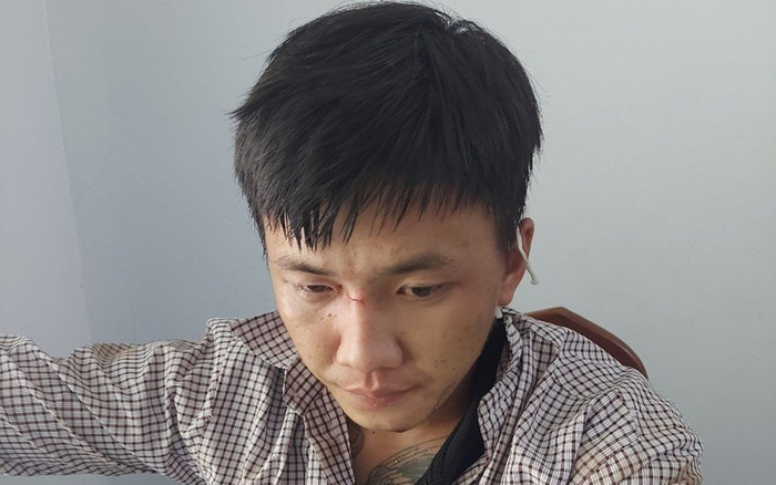 Người phụ nữ U60 'bay hồn vía' sau màn làm liều của thanh niên 22 tuổi Ảnh 2