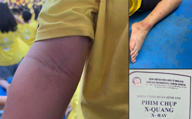 Vụ bé trai bị đánh khi tham gia khóa tu ở chùa Cự Đà: Trích xuất camera để xác minh Ảnh 2