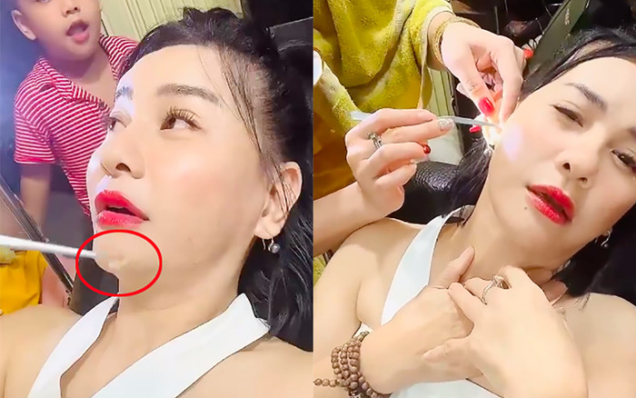 Nghệ sĩ Cát Phượng phát hiện dị vật trong tai, là thứ gì mà khiến cô khóc thét? Ảnh 2