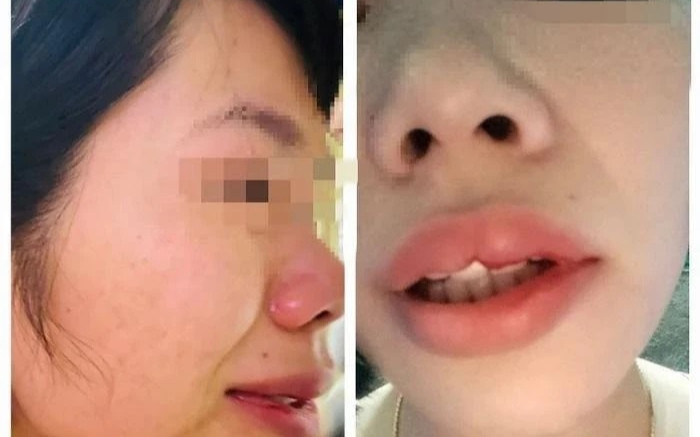 Cái kết 'đắng' cho thầy giáo đánh đồng nghiệp vì con bị xếp hạnh kiểm trung bình Ảnh 2
