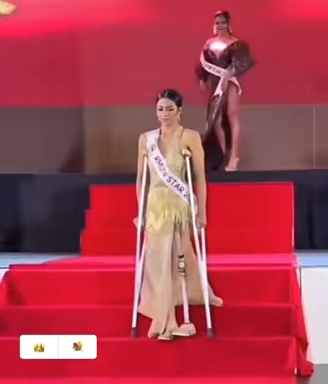 Cô phải lắp chân giả và dùng nạn để di chuyển.