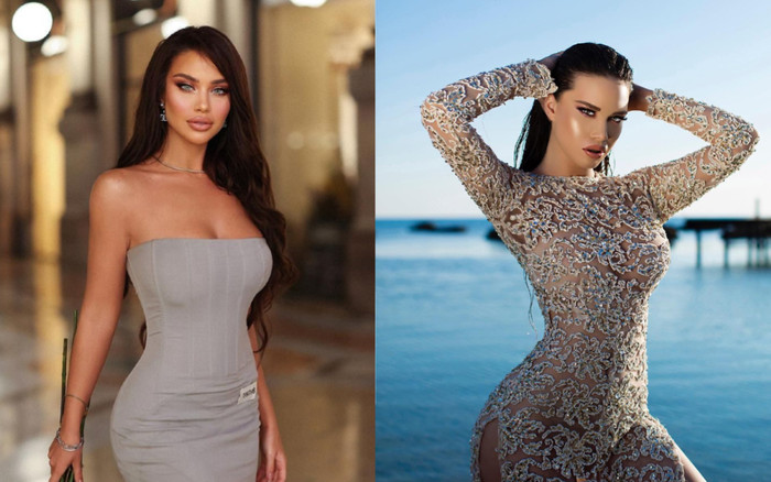 Body 'phồn thực' của Hoa hậu Hoàn vũ Albania: Việt Nam cử ai đi cũng bị lép vế vì cô ấy Ảnh 2