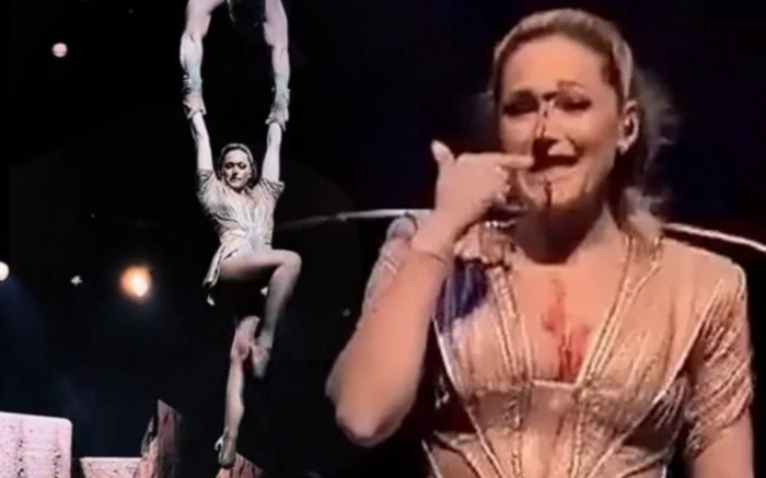 Nữ ca sĩ bị rạch đứt mặt trên sân khấu, phải hủy bỏ buổi biểu diễn khẩn cấp Ảnh 2