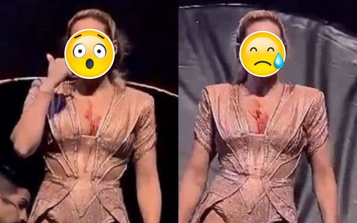 Nữ ca sĩ bị rạch mặt, ngã đập đầu trên sân khấu khi đang biểu diễn Ảnh 2