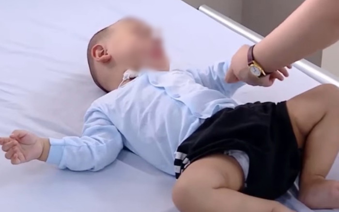 Bé trai 10 tháng tuổi nhập viện khẩn, nguy kịch vì món ăn mọi nhà thường nấu cho con trẻ Ảnh 2