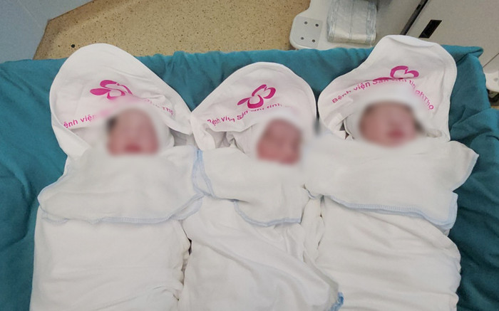 Người phụ nữ mang tam thai cực hiếm gặp từ hai trứng, hai tinh trùng Ảnh 2