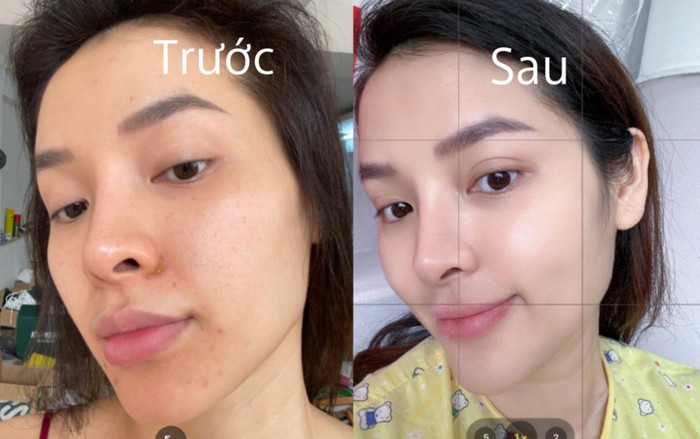 Phương Trinh Jolie khoe 'bí thuật' khiến da căng bóng như gương sau sinh khiến dân mạng bất ngờ Ảnh 2