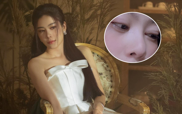 Nam Em gây lo lắng với gương mặt hốc hác, mắt sưng vù: Chuyện gì đang xảy ra? Ảnh 2