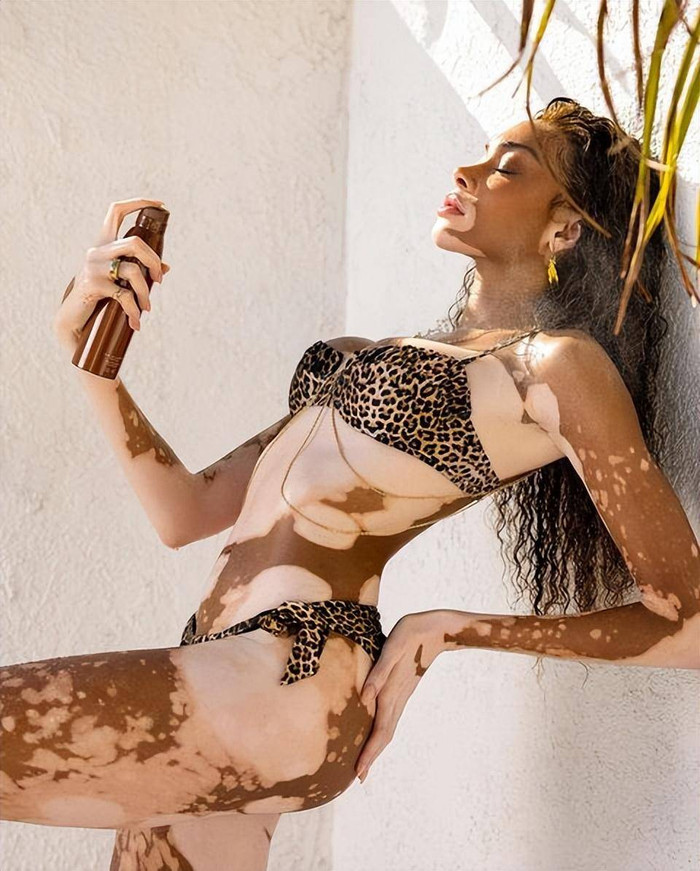 Siêu mẫu bạch biến Winnie Harlow thả dáng 'cực bốc': Khiêu vũ cuốn hút trong bikini da báo Ảnh 1