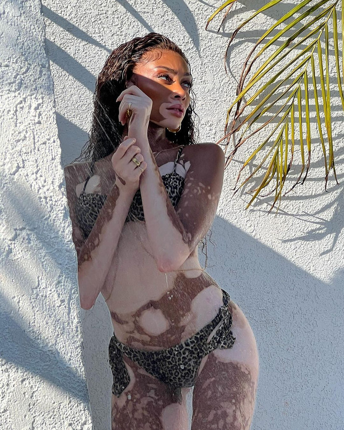 Siêu mẫu bạch biến Winnie Harlow thả dáng 'cực bốc': Khiêu vũ cuốn hút trong bikini da báo Ảnh 4