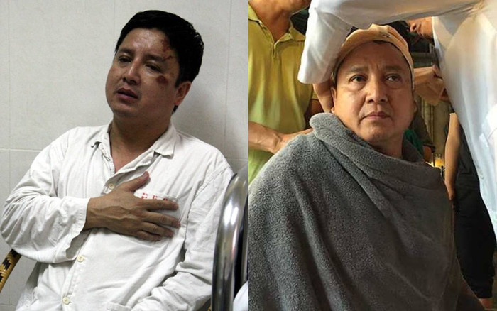 3 lần gặp tai nạn của 'Táo giao thông': Dây thừng 'thắt' vào đầu, bị tông xe và một lần suýt mất mạng Ảnh 2