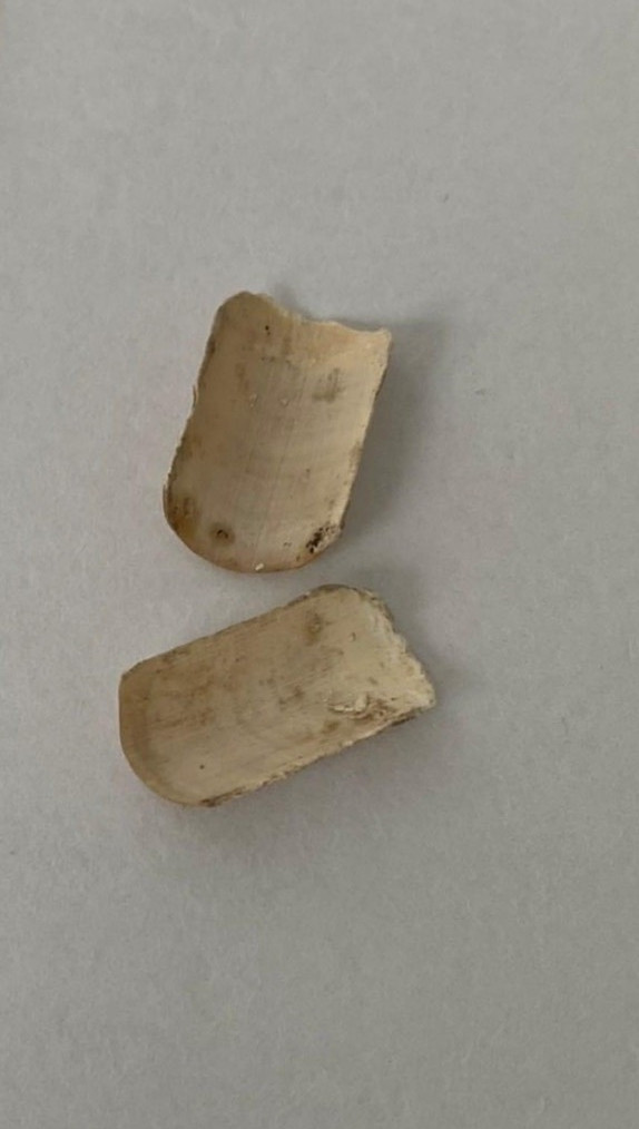 Phần móng tay nạn nhân. (Ảnh: CA).