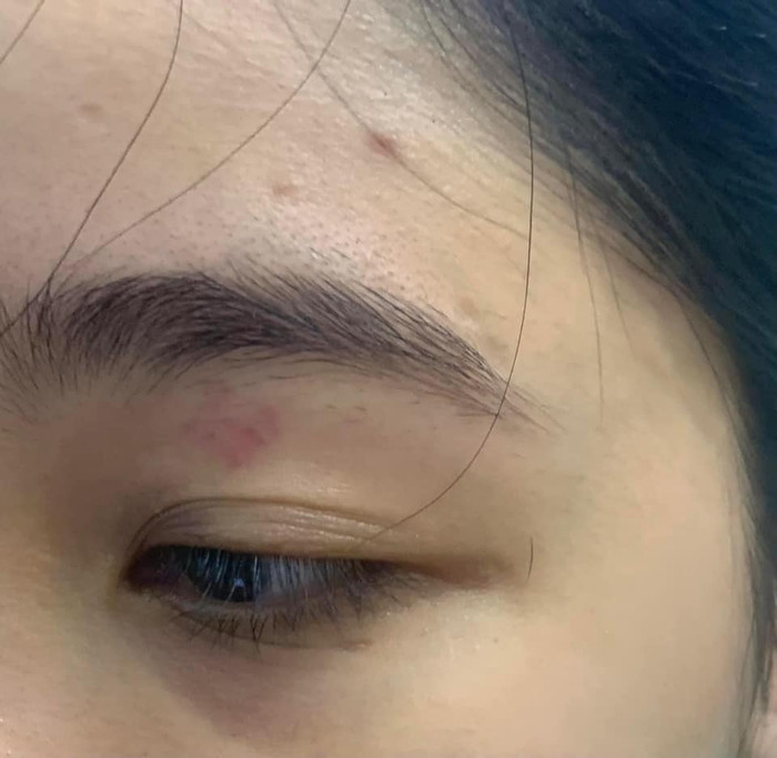 Chị K.A. tố bị cửa hàng đánh khi đến ăn bánh mì.