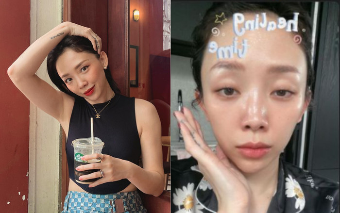 Tóc Tiên bị lệch mặt về một bên, lý do khiến ai cũng bất ngờ Ảnh 2