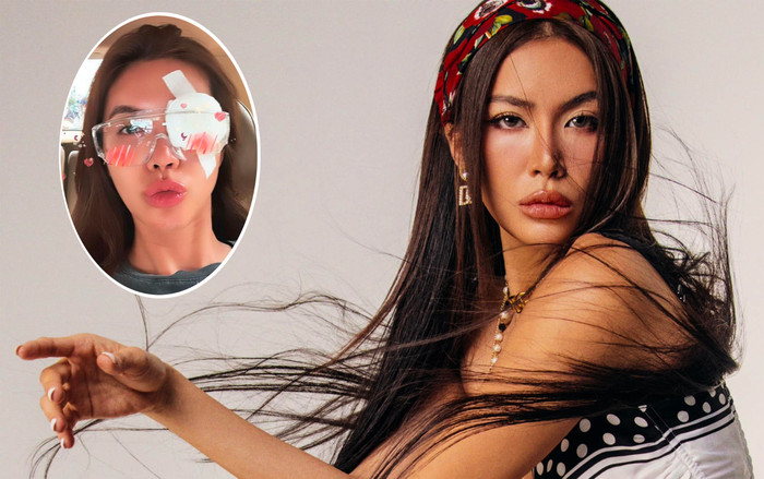 Minh Tú lại gặp sự cố ở mắt sau tai nạn phải may 10 mũi tại cằm Ảnh 2
