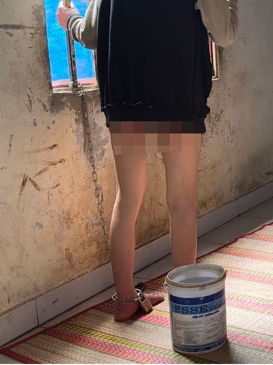 Một phụ nữ bị xích chân, không mặc quần