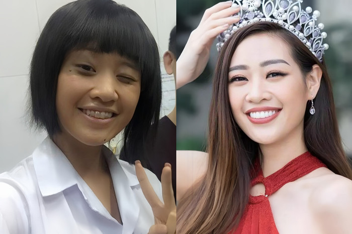 Không riêng gì Ý Nhi, Hoa hậu Hoàn vũ Việt Nam 2019 - Nguyễn Trần Khánh Vân cũng từng có quãng thời gian đồng hành với mắc cài kim loại ngay từ những ngày còn cắp trường. 