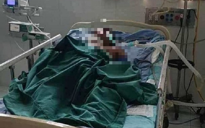 Đi lấy tổ ong để mưu sinh, người đàn ông phải trả giá bằng cả tính mạng Ảnh 2