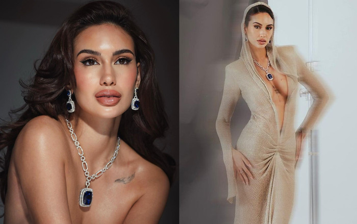 Hoảng sợ đôi môi sưng 'như ong đốt' của hoa hậu 'nóng bỏng' nhất Philippines Ảnh 2