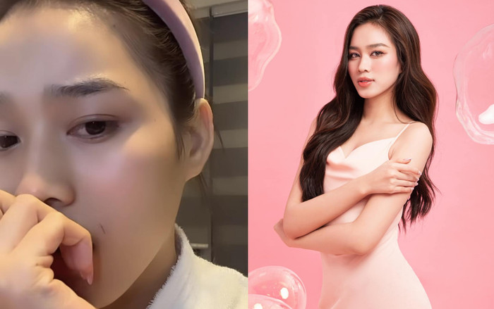 Hoa hậu Đỗ Thị Hà vô tình tự tạo vết thương trên má, để lộ biểu cảm hoang mang Ảnh 2