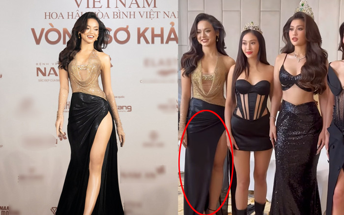 Mê diện váy xẻ cao, Mai Ngô '5 lần 7 lượt' lộ chân kém thon qua ảnh chưa chỉnh sửa Ảnh 2