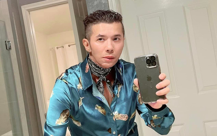 Ca sĩ Kasim Hoàng Vũ mặt biến dạng, tiết lộ vừa phải phẫu thuật xương hàm Ảnh 2