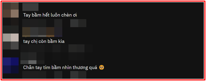 Chi Pu để lộ thương tích khi tham gia Đạp gió tại Trung Quốc khiến khán giả xót xa Ảnh 3