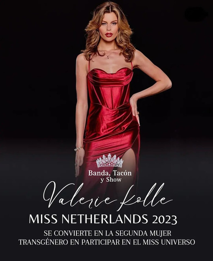 Người đẹp Rikkie Valerie Kollé.