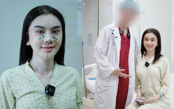 Lâm Khánh Chi tiếp tục tu sửa nhan sắc, đẹp lắm rồi sao còn chỉnh? Ảnh 2