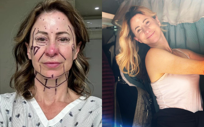 Bán nhà để phẫu thuật căng da mặt, cái kết khiến người phụ nữ ngỡ ngàng Ảnh 2