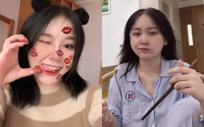 TikToker Min Min cười 'tươi như hoa' sau khi xuất viện vì ngộ độc khí N2O Ảnh 2